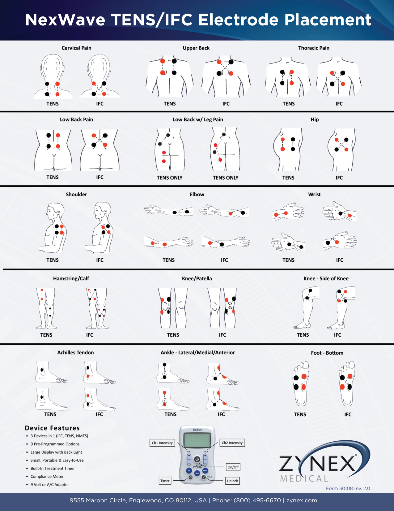 Tens Electrode Placement Chart book cover